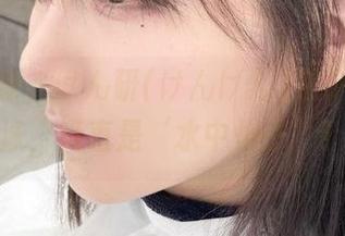 First Image