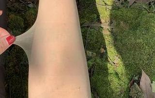 First Image