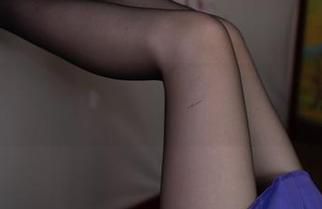 First Image